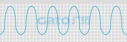 干貨|太全了，振動光纖7大場景的安裝方式圖文詳解！(圖21)
